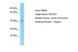 OR10S1 Rabbit anti-Human, Polyclonal, Novus Biologicals 0.1 mL | Buy Online | Novus Biologicals | Fisher Scientific